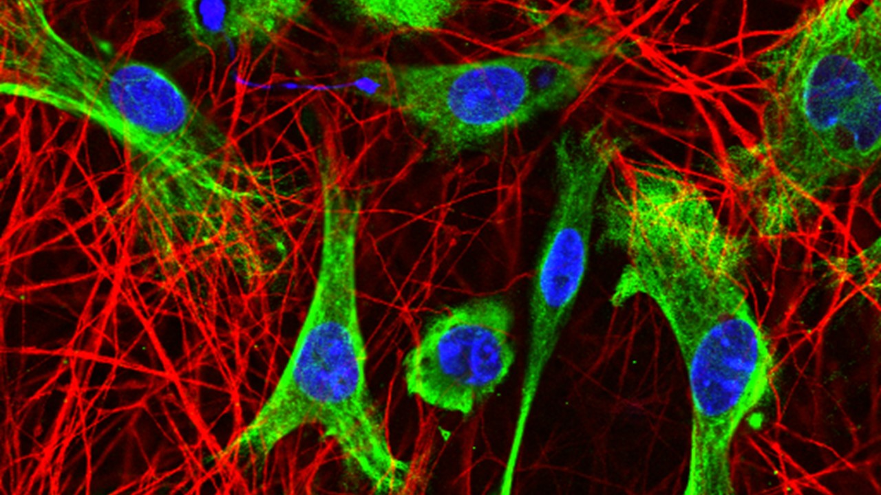 Fluorescence microscopy image of astrocytes