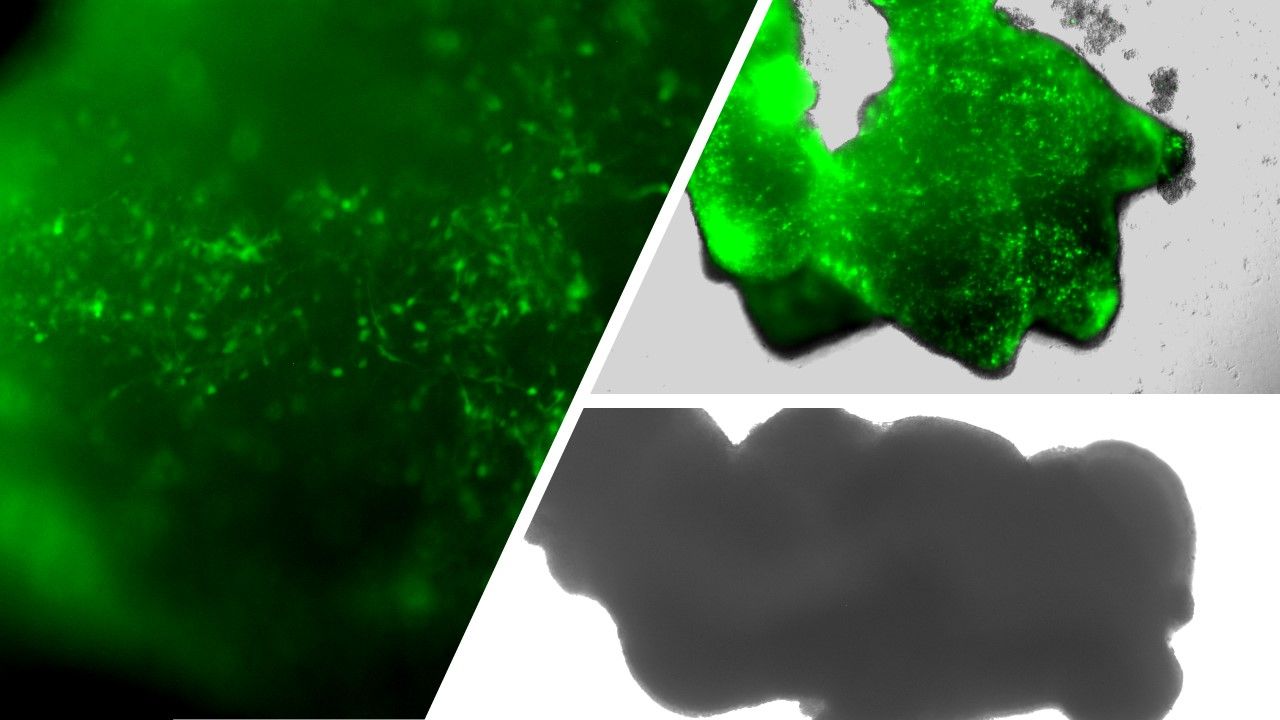 Fluorescence image of a GFP-labelled assembloid at 100 days in vitro
