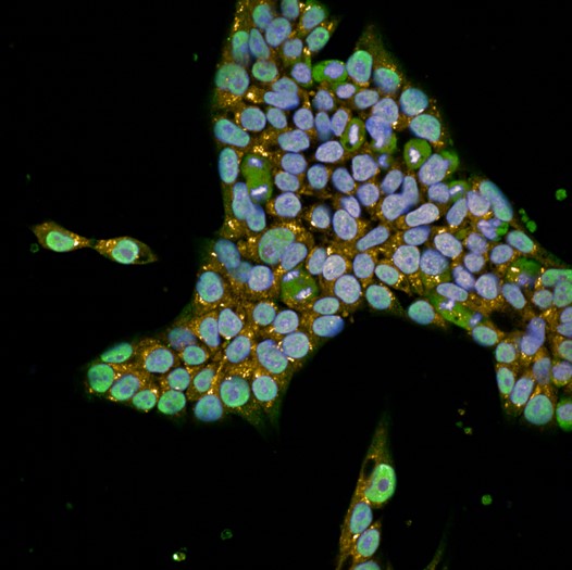 Fluorescence microscopy image of human stem cells with TDP-43 staining