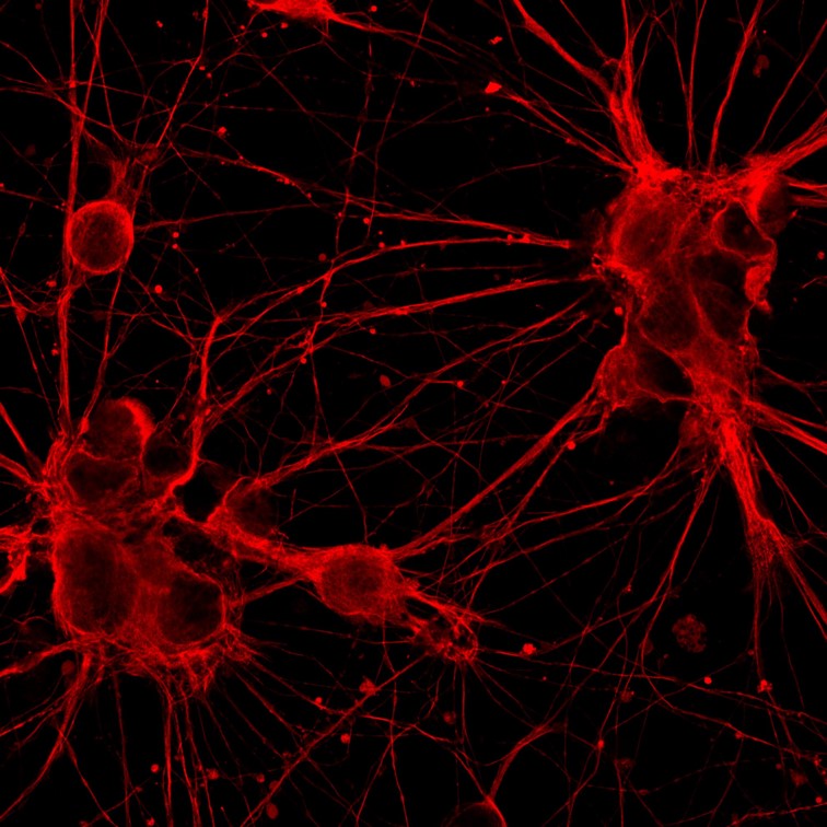 Fluorescence microscopy image of motor neurons
