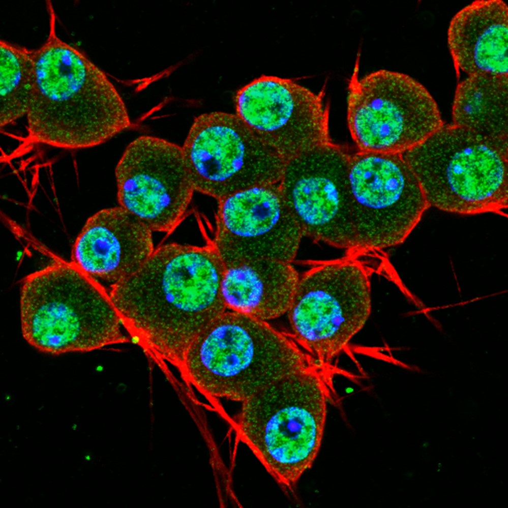 Fluorescence microscopy image of nerve cells with TDP-43 staining