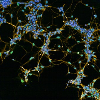 Fluorescence microscopy image of nerve stem cells