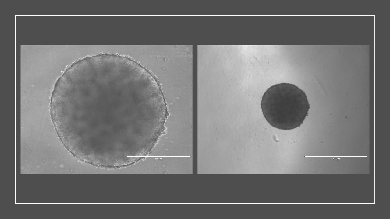 Brightfield image showing organoid expansion