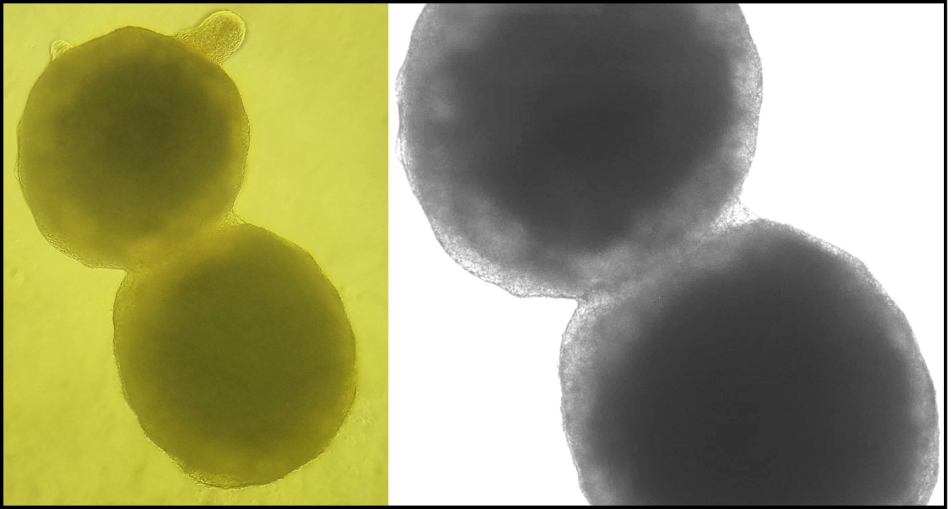 Brightfield image of fused human brain organoids
