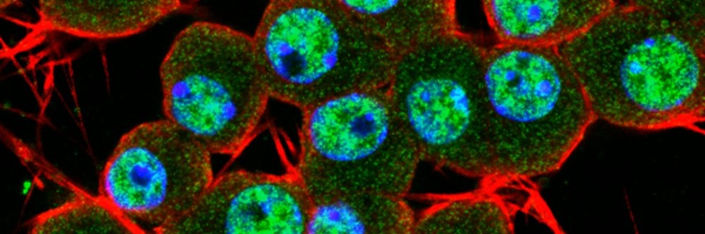 Microscopy banner image of human neurons