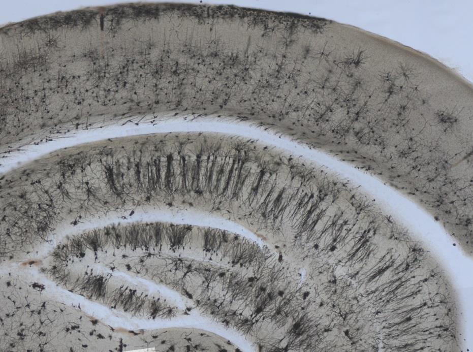 Golgi-stained section of mouse hippocampus