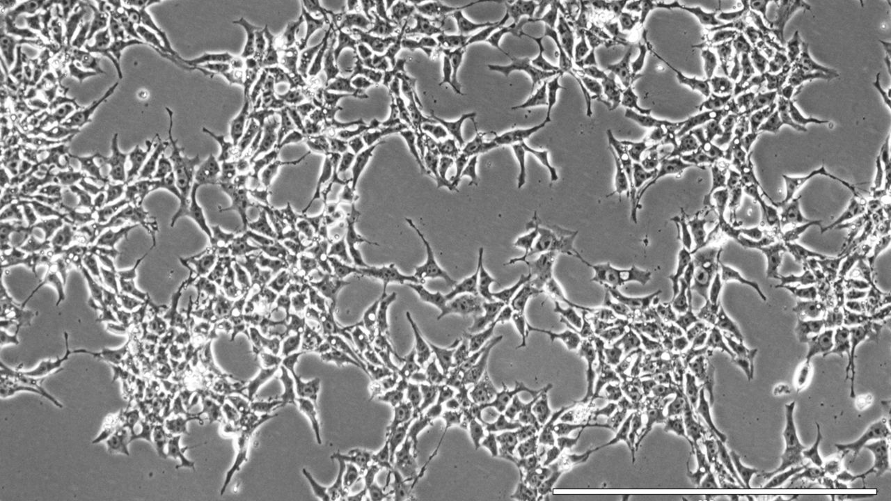 Brightfield image of induced pluripotent stem cells