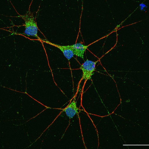 Fluorescence microscopy image of neurons