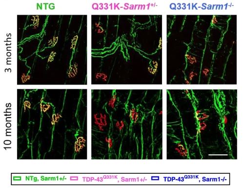 Example figure from Acta Neuropathologica Communications paper
